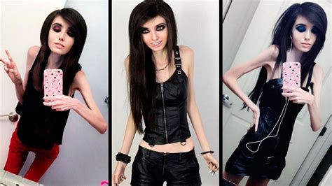 anorexicas xxx|'anorexic' Search .